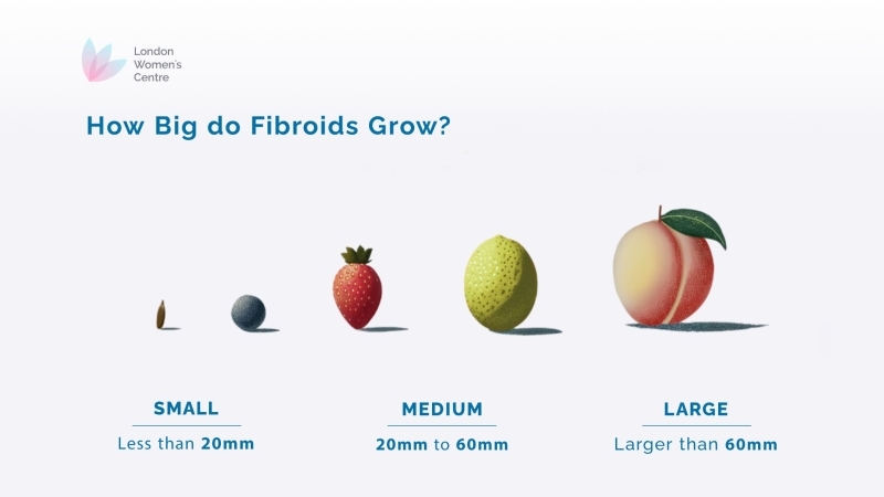 illustration of the fibroid sizes on a neutral background.
